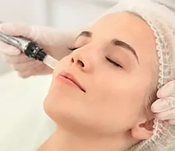 Microneedling