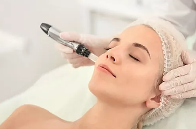 Microneedling